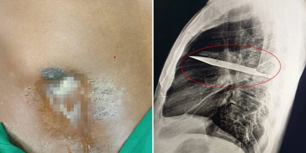 knife chest man tanzania