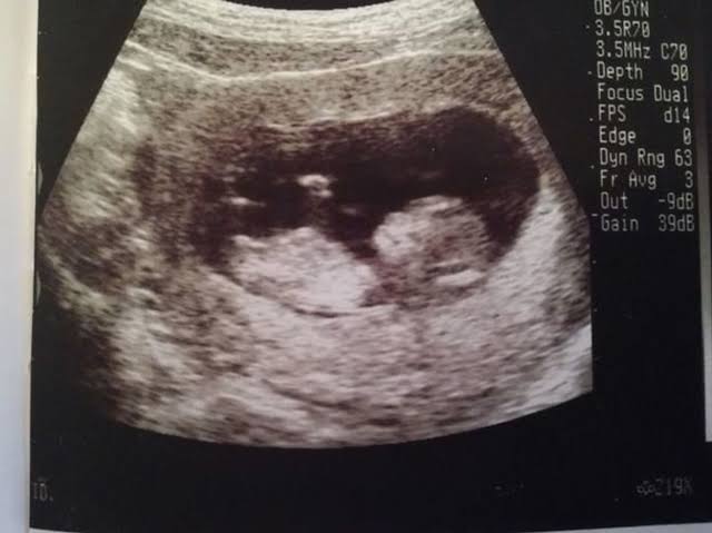 marketplace ultrasound images example