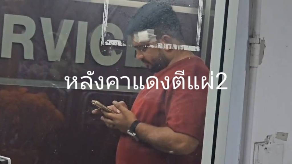 tourist transgender woman genitals