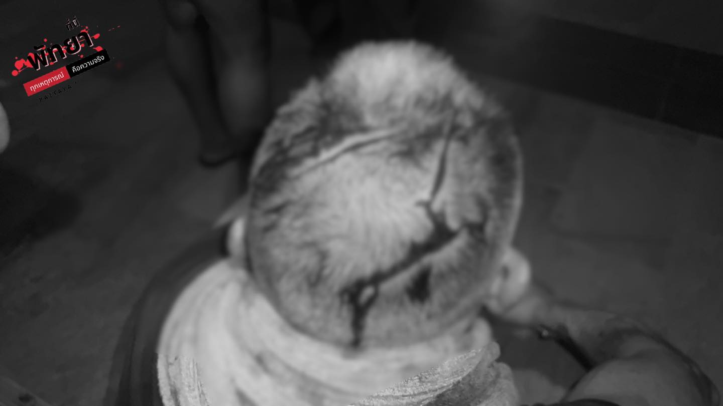 british slashed transgender women