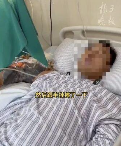 man arm crushed china