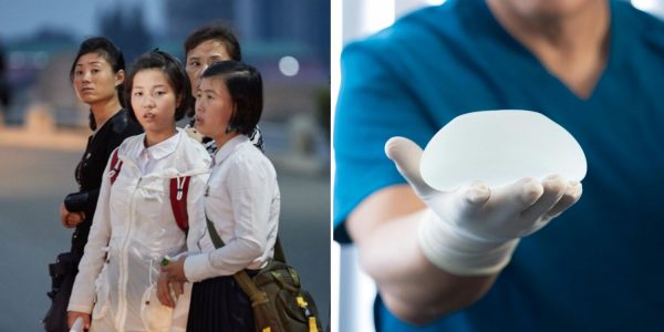 breast augmentation north korea