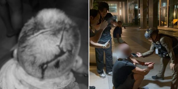 british slashed transgender women