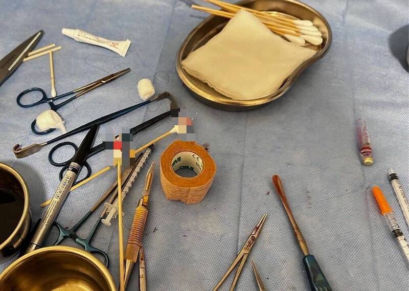 illegal cosmetic surgeries (3)