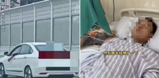 man arm crushed china