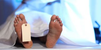 man brain dead funeral