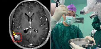 parasite worm mosaic vision