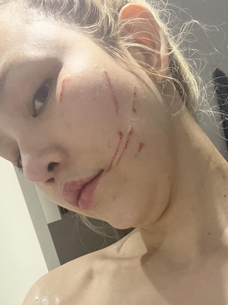 thai influencer cuts face injuries