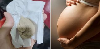 woman gauze postpartum pain