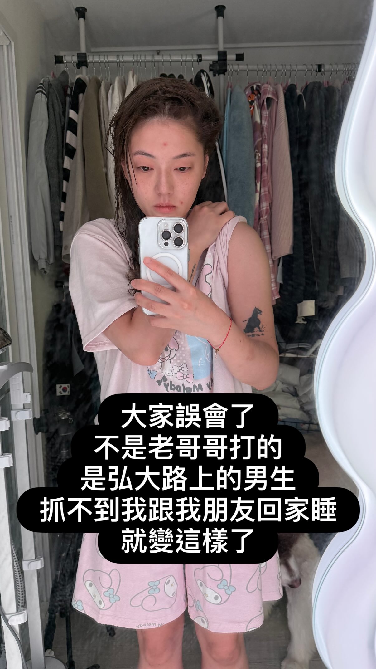 youtuber south korea bruises (2)