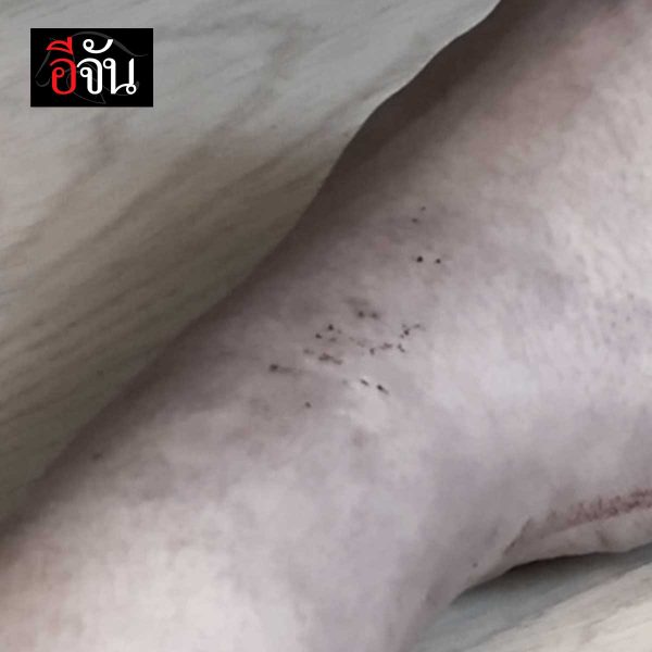 man grandmother cobra