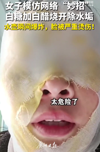 woman facial burns limescale