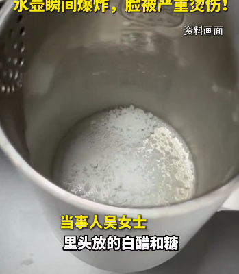 woman facial burns limescale