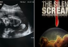abortion video