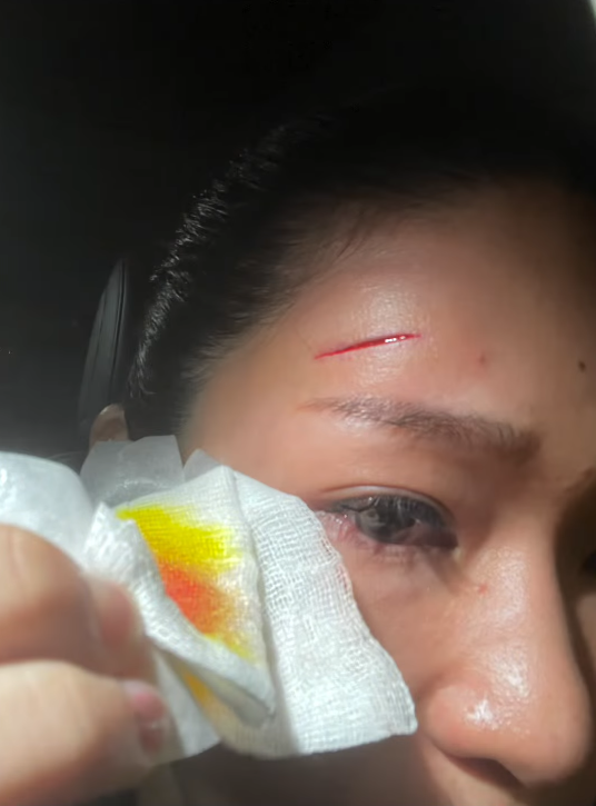 coach injuring female referee