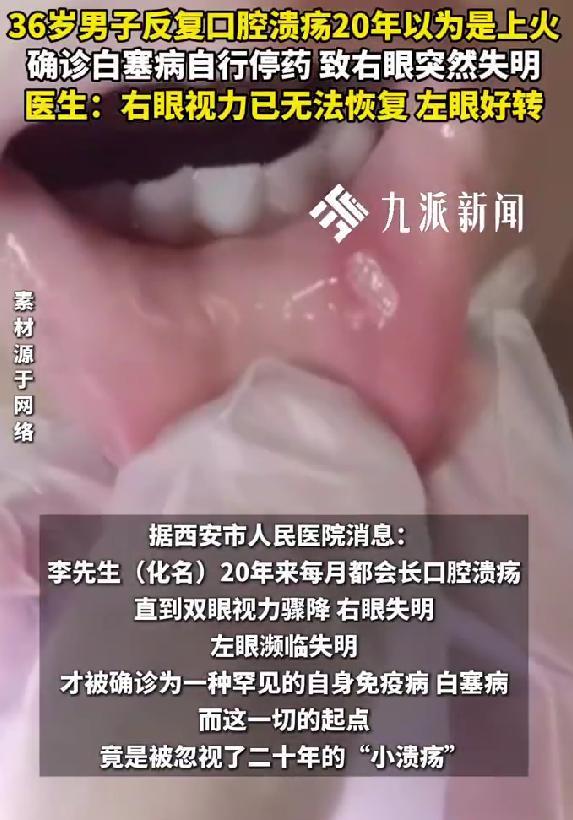 man blind ulcers medication