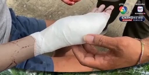 father daughter argument saw injury