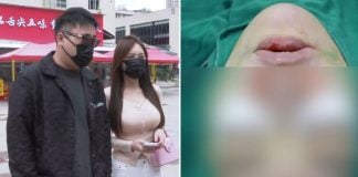 girlfriend cosmetic surgery