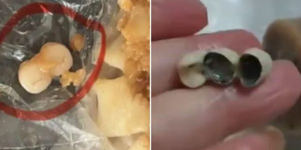 human teeth sausages dim sum