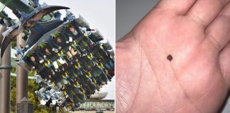 kidney stone roller coaster