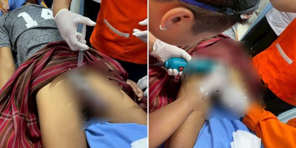 man locks penis rings