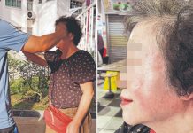 punched elderly