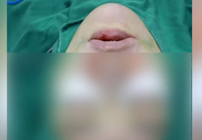 girlfriend cosmetic surgery