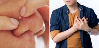 lung necrosis popping pimple