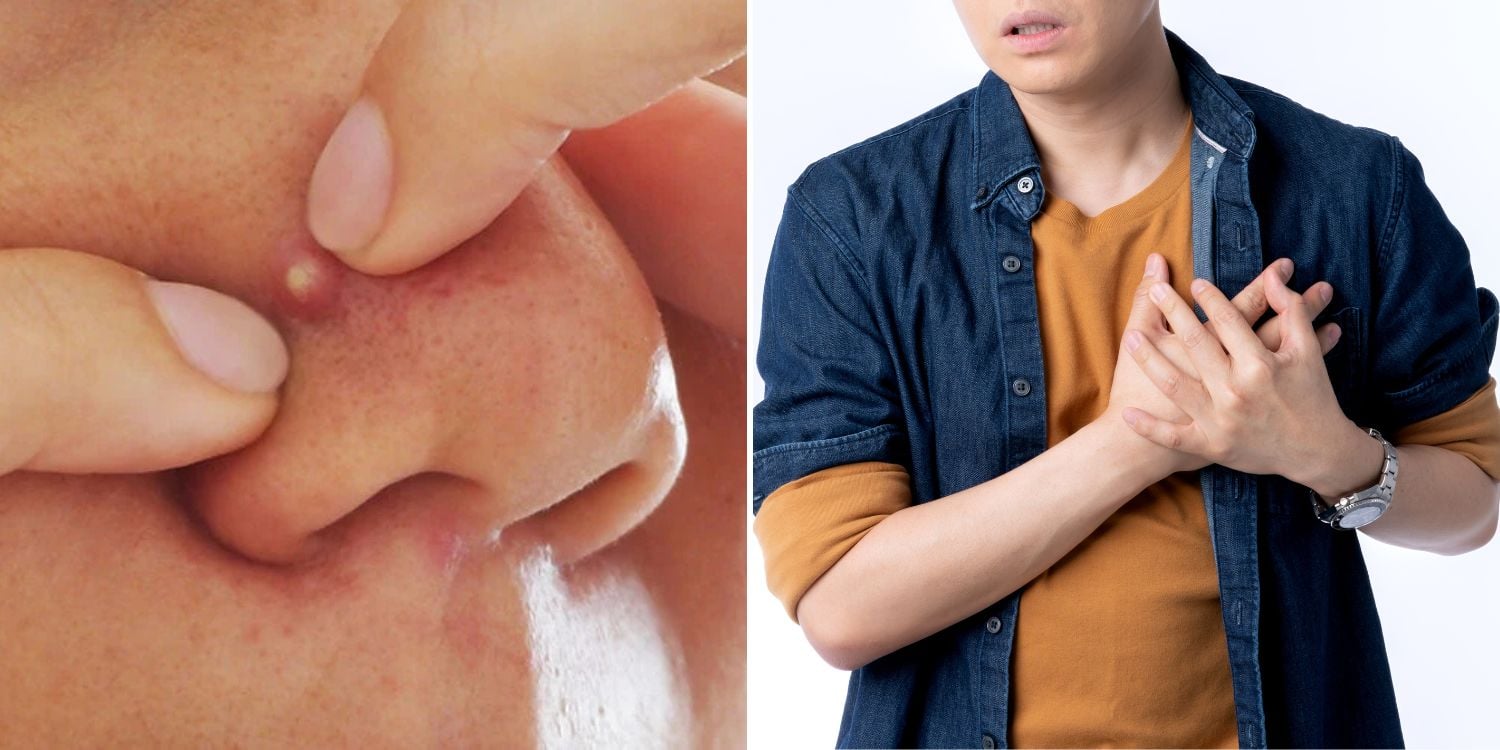 lung necrosis popping pimple