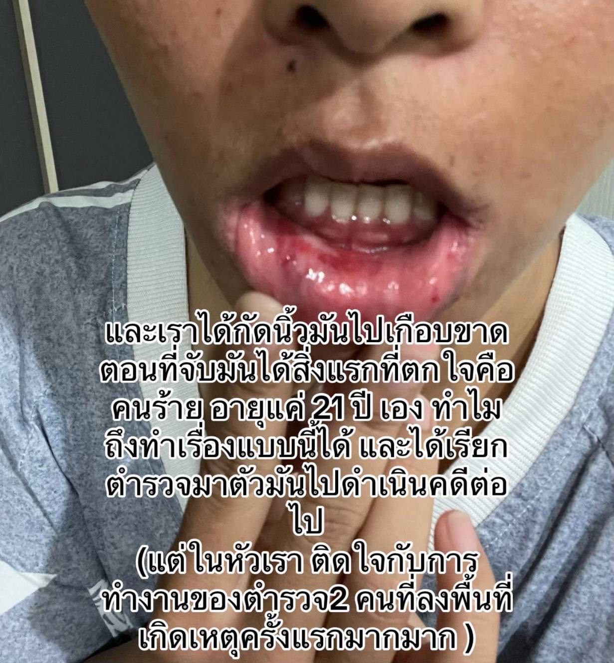 female rider sexually assaulted injuries