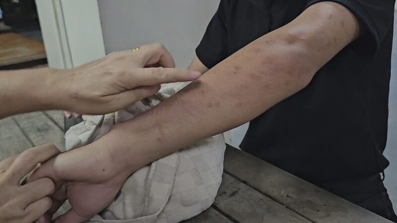 student frozen account mosquito