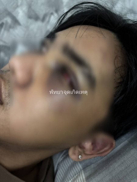 man assaulted woman house