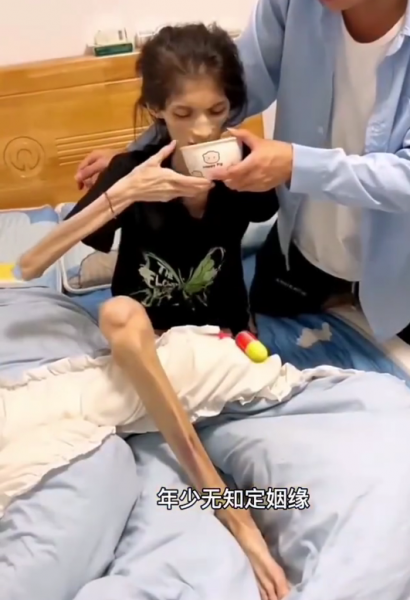 woman gastric atrophy