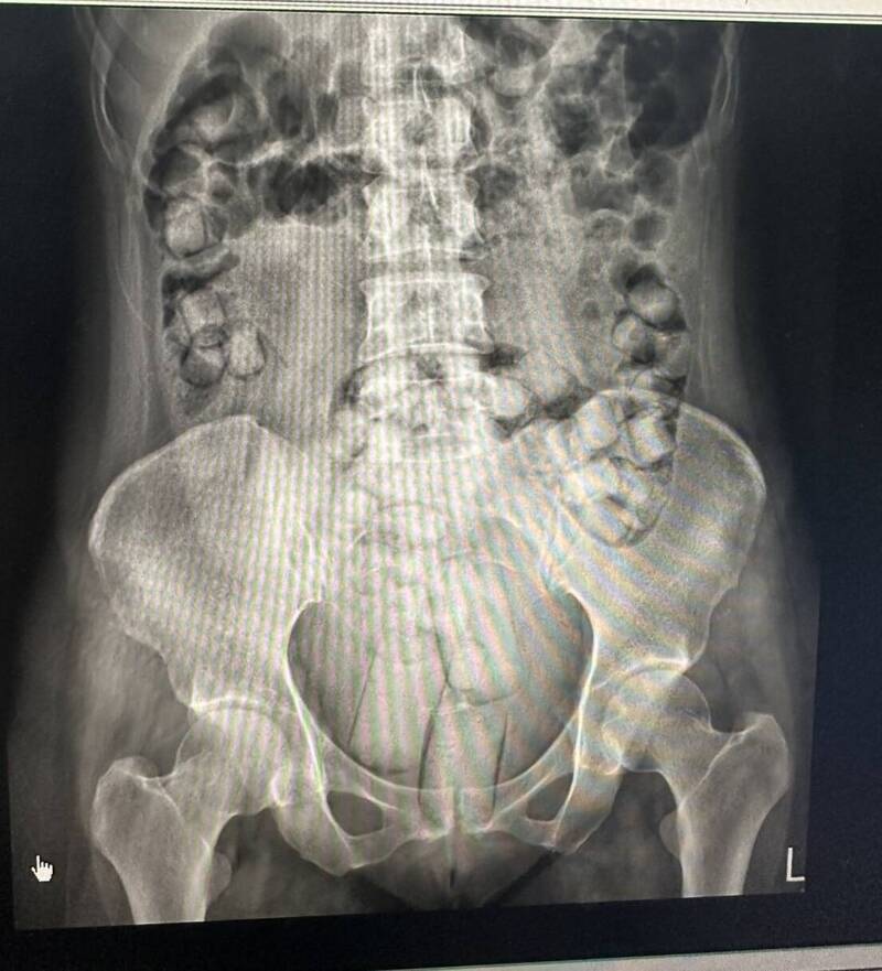 Thai women arrested Taiwan heroin (2)