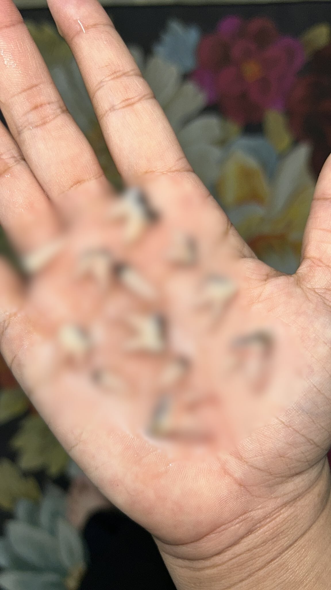 boy 12 extracted teeth