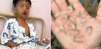 boy 12 teeth extracted (2)