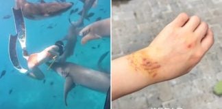 chinese woman bitten shark maldives