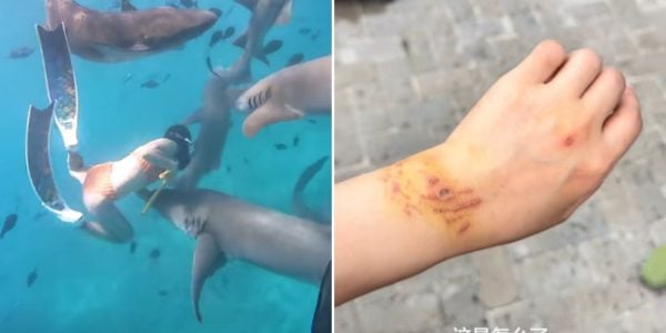 chinese woman bitten shark maldives