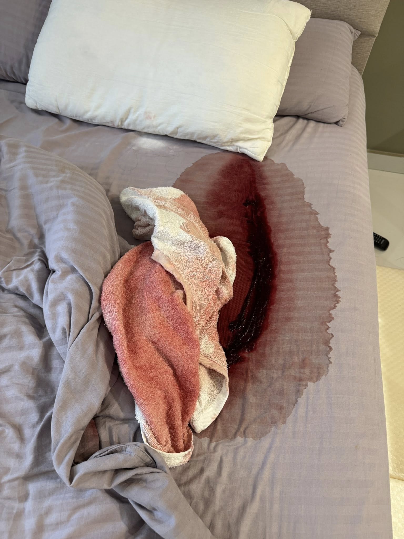 guest homestay red stains towel