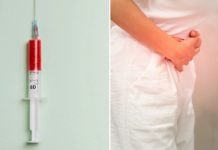 woman weight-loss treatment