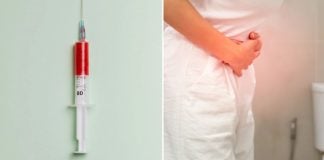 woman weight-loss treatment