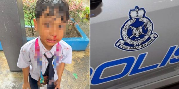 boy slapped walking slowly