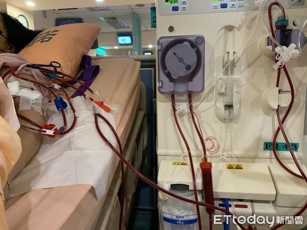 woman dialysis bubble tea