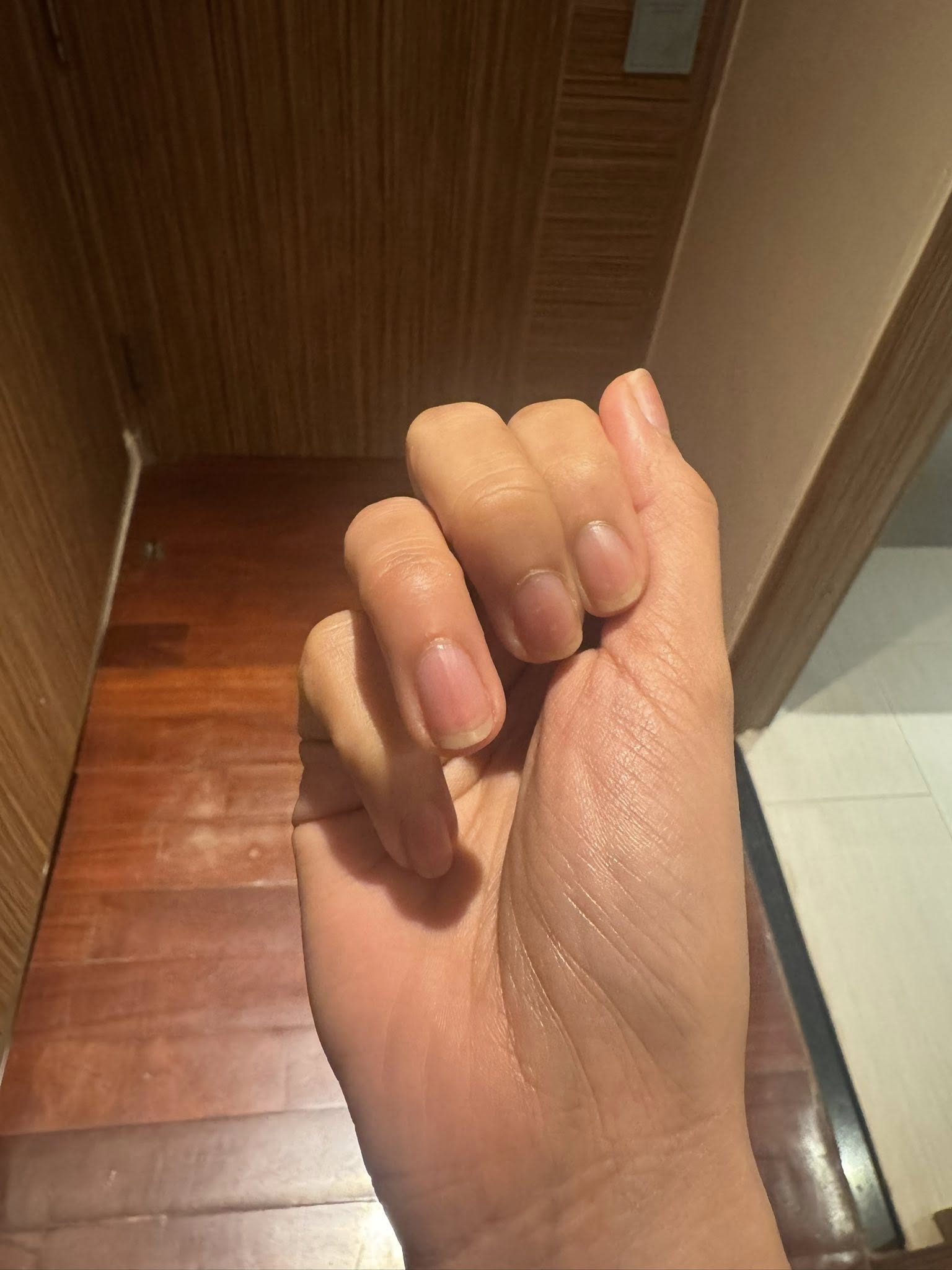 dj hotel room keycard injury