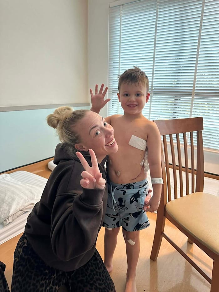 glass door stitches recovering