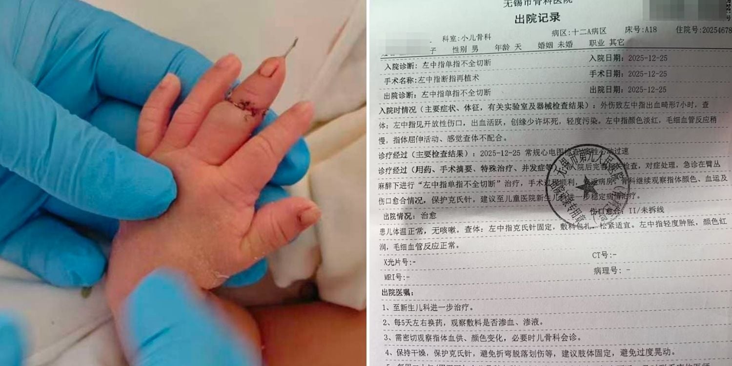 midwife newborn's finger