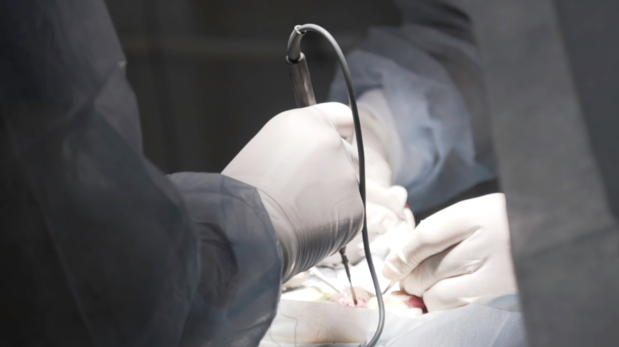 penis shrinks surgery spain (1)