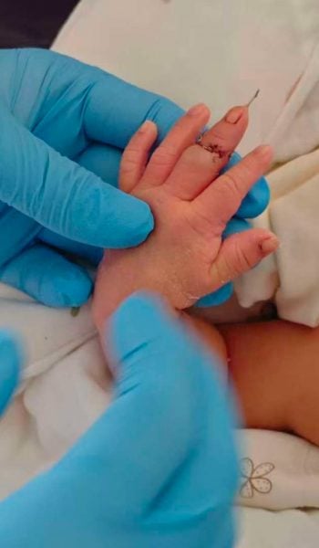 midwife newborn's finger