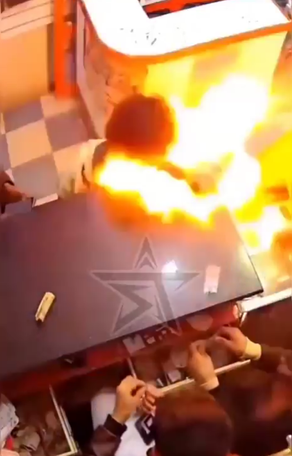 battery exploded boy mouth