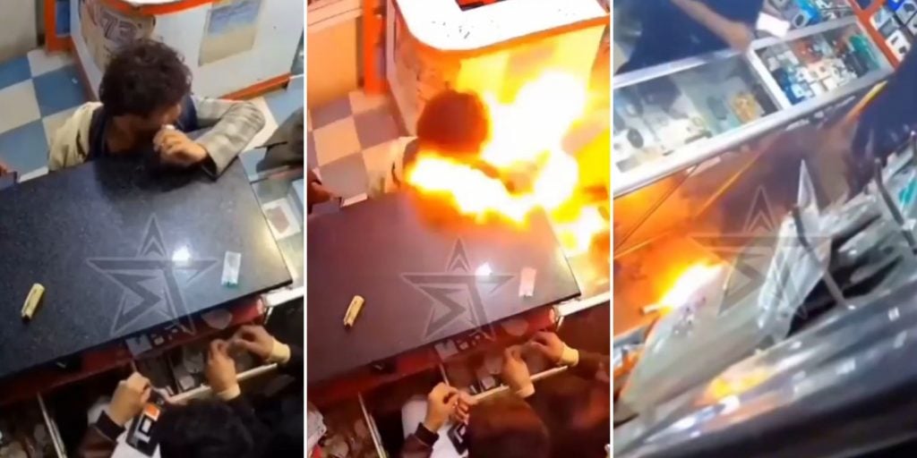 battery exploded boy mouth